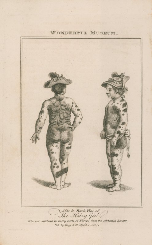 Side and Back View of the Hairy Girl by English School