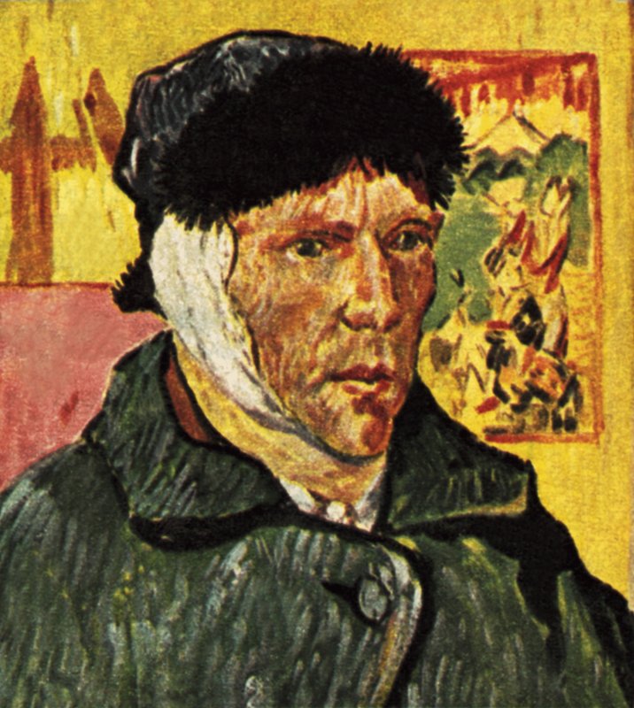 Van Gogh with a Bandage Round His Head (Redrawn) by English School