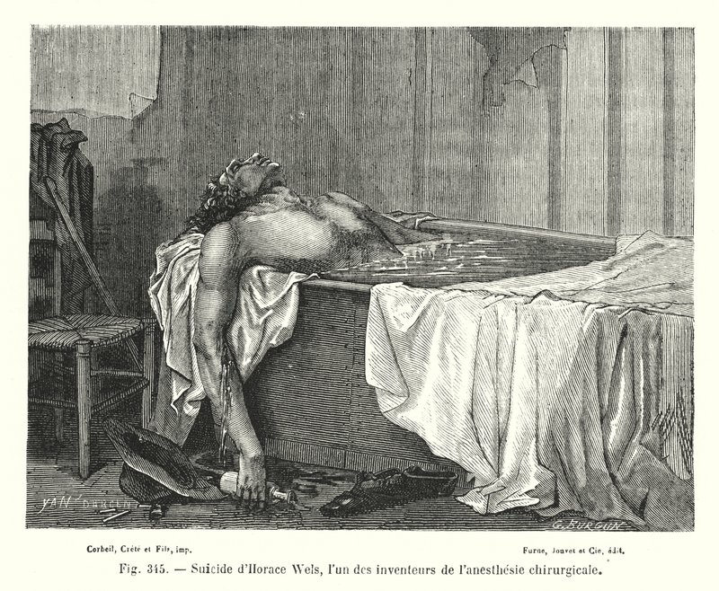 Suicide of Horace Wells, One of the Inventors of Surgical Anesthesia (engraving) by European School