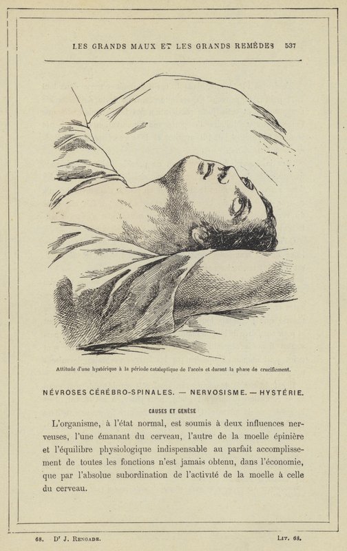 Attitude of a Hysterical Person in the Cataleptic Stage of the Attack and During the Crucifixion Phase by French School