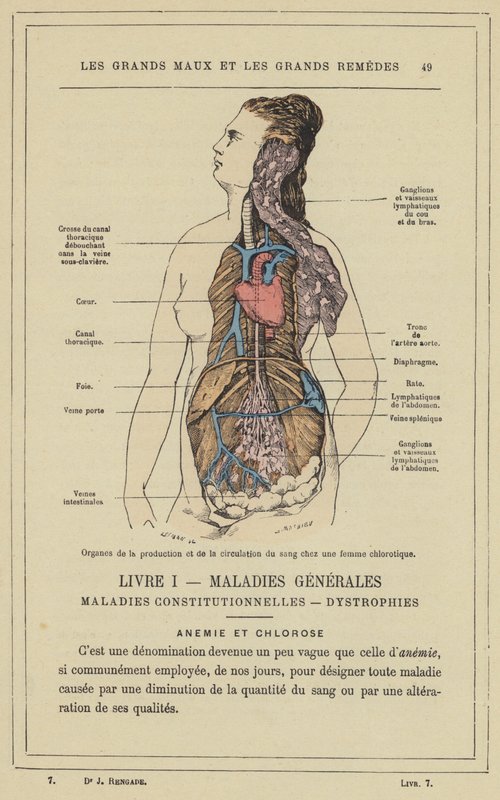 Organs of Blood Production and Circulation in a Chlorotic Woman by French School