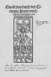 The Book of Cirurgia by Hieronymus Brunschwig