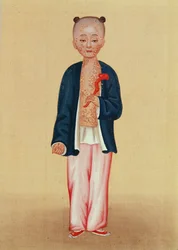 Child with smallpox
