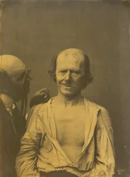 A relaxed face left, False joy or laughter right, 1854-1856, printed 1862