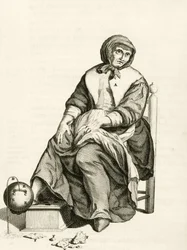 Using a Mechanical Leech, from Exercitationes Practicae circa Medendi Methodum by Frederik Dekkers, 1694