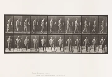 Hemiplegia; Walking with Cane