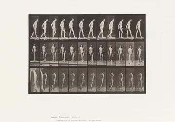 Plate 559. Disseminated Sclerosis; Walking with Cane
