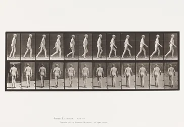Lateral Curvature of Spine; Walking (Plate 562)