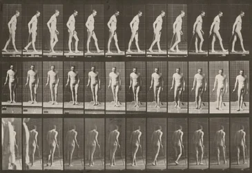 Plate Number 559. Partial Paraplegia, Walking with Cane