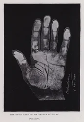 The right hand of Sir Arthur Sullivan