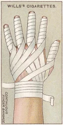 Continuous Finger Bandage, no.48 from the First Aid series of Wills Cigarettes cards, 1913