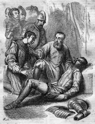 Ambroise Pare, French Surgeon