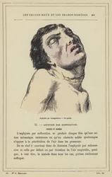 Asphyxia by strangulation, a hanged man