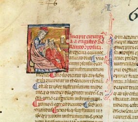 Trepanation, from Chirugie de Maitre Rolandi