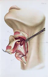 Plate from Atlas and Epitome of Operative Surgery by Dr. Otto Zuckerkandl, 1910