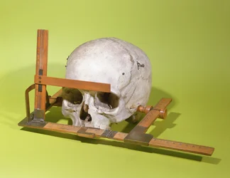Skull in a Facial Goniometer Constructed by Paul Broca