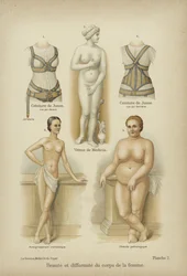Beauty and Misshapenness in the Female Body