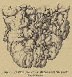 Bovine tuberculosis