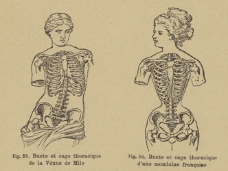 Comparison of the shape of the chest and ribcage of the Venus de Milo with that of a late 19th Century French socialite
