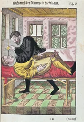 Eye Operation, from Ophthalmodouleia by Georg Bartisch published in Dresden in 1583