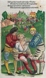 Removing an Arrow, Illustration from Feldtbuch der Wundartzney by Hans von Gersdorff