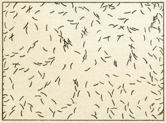 Sample of bacteria in tapwater