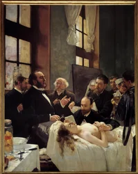 Dr. Jules-Émile Péan (1830-1898) Teaching at Hôpital Saint-Louis His Discovery of Vessel Clamping. “Before the Operation”. Painting by Henri Gervex (1852-1929), 1887. H. 2.42 x 1.88 m, Paris, Musée d