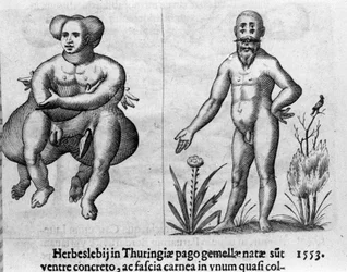 Different types of human monsters. Engraving from “De monstrorum natura, causis et differentiis” by Fortunio Liceti (1577-1656), Italian scientist. 1646
