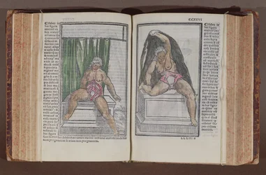Female anatomy, from Commentaria cum amplissimis additionibus super anatomiam mundini, by Jacopo Berengario da Carpi published in Bologna, 1521