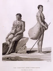 Northern Mariana Islands: Two Men Suffering from Tuberculosis, from 