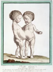 Siamese Children - in 