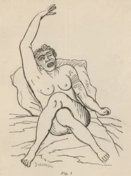 Hysterical Epilepsy, Attack, Contortions, fig. 1 from 