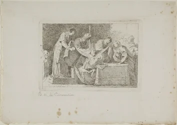 Circumcision