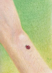Gentle Ladybug On Arm