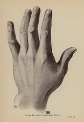 The Elementary Hand