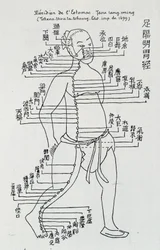 Acupuncture: 