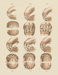 Description of Plate Showing the Age, as Indicated by the Teeth