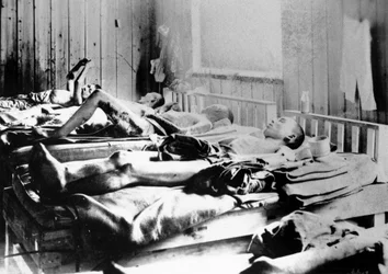 Survivors of the explosion of the Atom bomb at Hiroshima, Japan