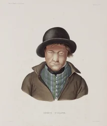 Leprosy Male leper, Iceland, early 19th century