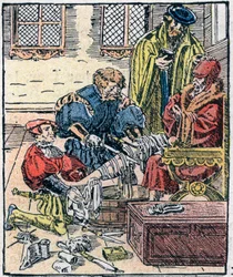 Amputation of a leg in the 16th century.
