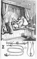Clystère (for enemas) by Johannes Sculptetus 