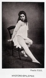 Hystero Epilepsie - Contracture in “Photographic iconography of the Salpêtrière: service of Mr. Charcot” by Paul Regnard and Bourneville