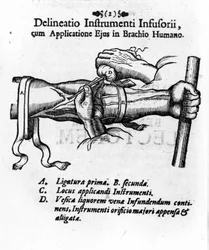 Intravenous injection using a clystery bladder. by J. D. Mayor, 