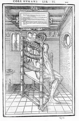 Skull Cut. Anatomical Board of De dissectione partium corporis humani lbri tres by Carlo Stefano Riverio, Paris 1545