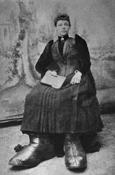 Les Monstres, Berthe aux Grands Pieds. Photography, Late 19th Century, Paris. Coll. Selva.