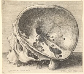 Sectioned Skull in Profile to Left with the Left Side of the Cranium Removed