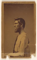 Unidentified Civil War Victim in Profile, Seated