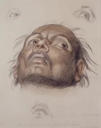 Study of an East Indian